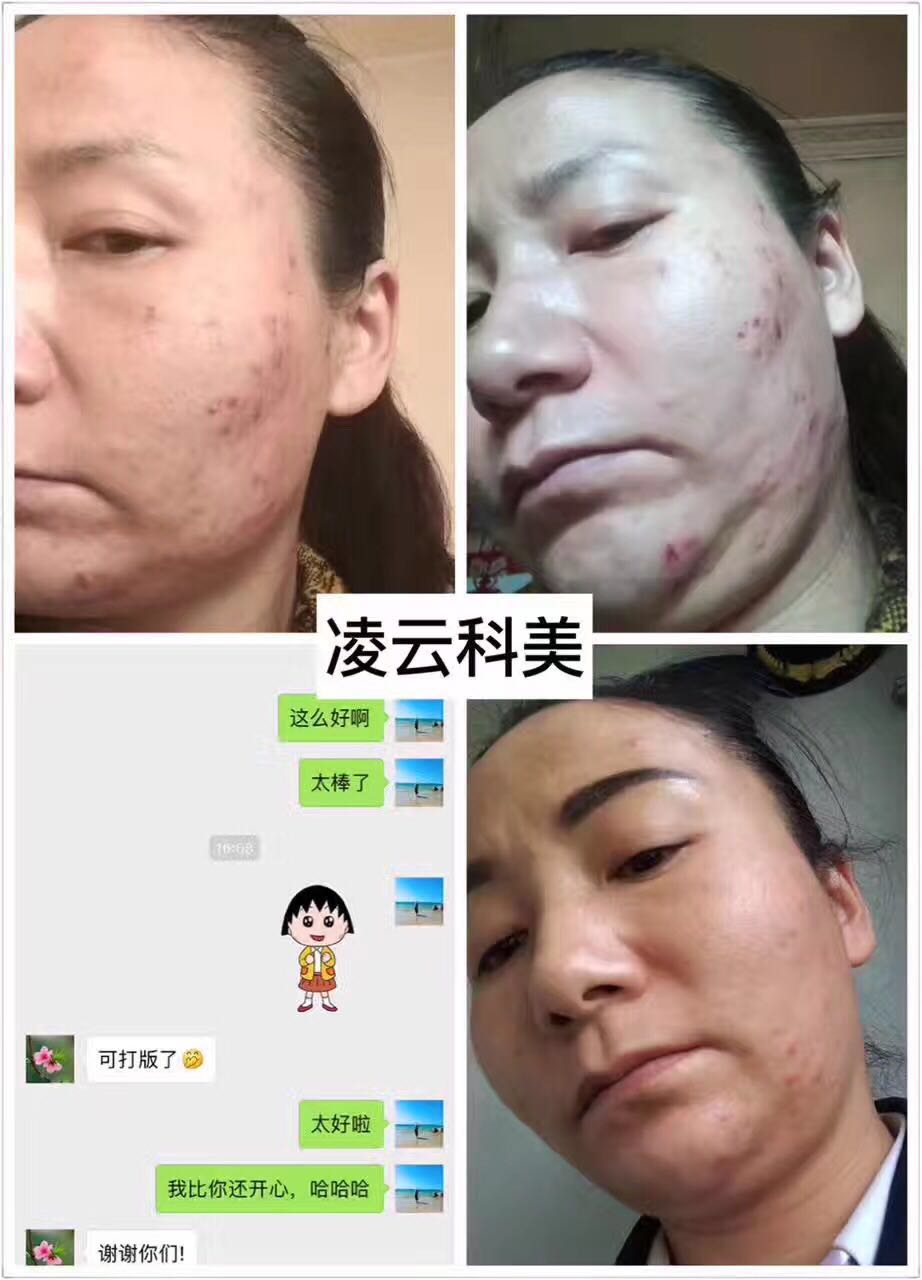 贵州光电美容